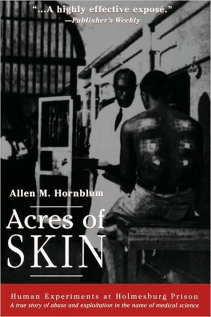 Acres of Skin av Allen M. Hornblum
