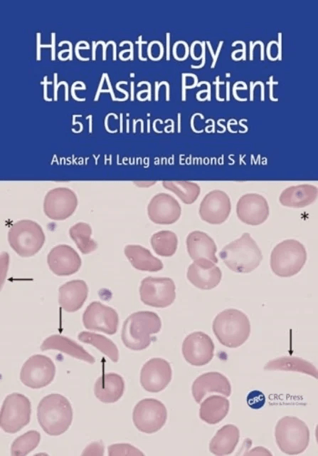 Haematology and the Asian Patient av Anskar Y.H. (University of Hong Kong) Leung, Edmond S K Ma