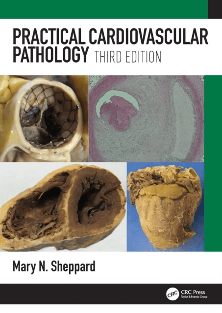 Practical Cardiovascular Pathology av Mary N. (St. George's University of London UK) Sheppard