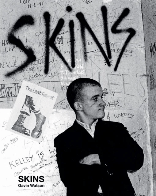 Skins av Gavin Watson