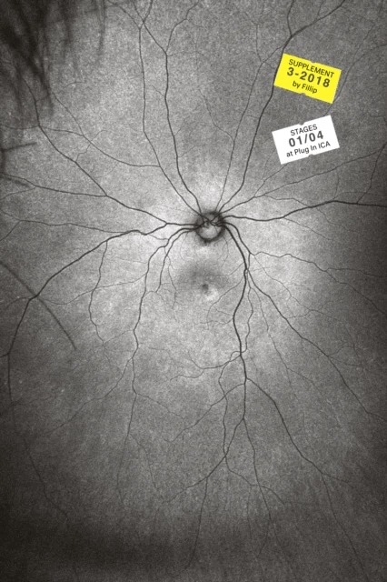 Supplement 3: The Invention and Conclusion of the Eye av Toril Johannessen