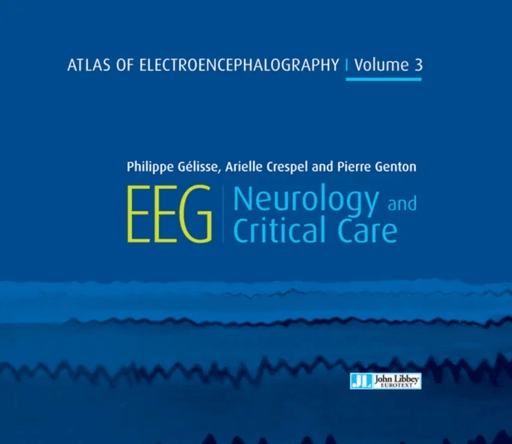 Atlas of Electroencephalography Volume 3 av Dr Philippe Gelisse, Dr Arielle Crespel, Pierre Genton