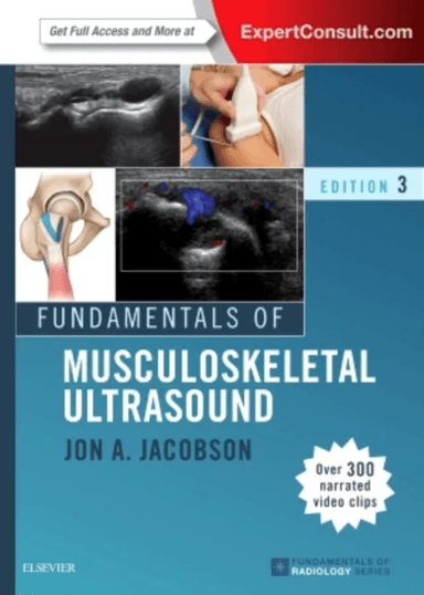 Fundamentals of Musculoskeletal Ultrasound av Jon A. (Professor of Radiology Lenox Hill Radiology New York NY) Jacobson