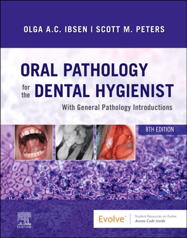 Oral Pathology for the Dental Hygienist av Olga A. C. (Adjunct Professor<br>Department of Oral and Maxillofacial Pathology Radiology and Medicin