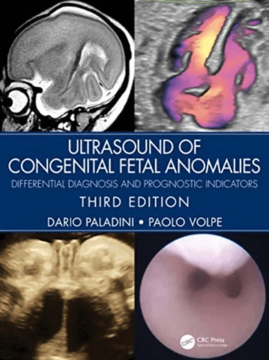 Ultrasound of Congenital Fetal Anomalies av Dario Paladini, Paolo Volpe