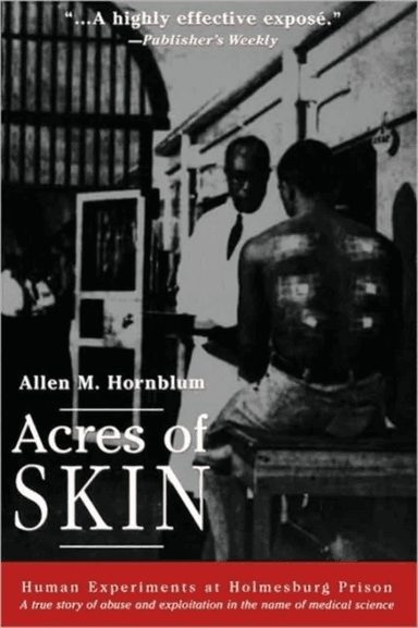 Acres of Skin av Allen M. Hornblum