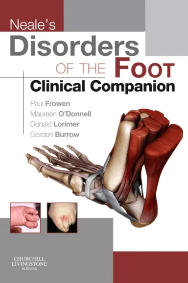 Neale's Disorders of the Foot Clinical Companion av Paul MPhil FCHS FCPodMed DPodM (Formerly Head of Wales Centre for Podiatric Studies Principal