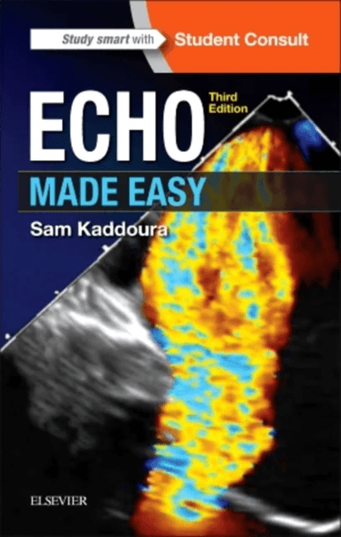 Echo Made Easy av Sam (Consultant Cardiologist at Chelsea and Westminster Hospital and Royal Brompton Hospital London Kaddoura, Royal Hospital Chelsea