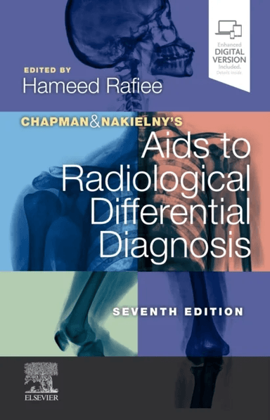 Chapman &amp; Nakielny's Aids to Radiological Differential Diagnosis