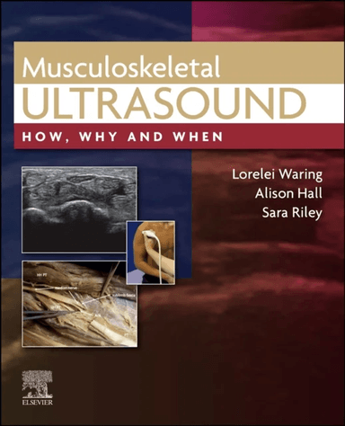 Musculoskeletal Ultrasound av Lorelei DCR (R) PgC AP MSc Medical Ultrasound FHEA (Senior Lecturer Department of Medical Sciences Institute of Health U