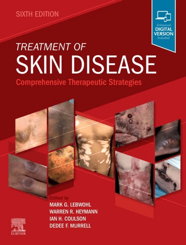 Treatment of Skin Disease av Mark (Chairman Emeritus Kimberly and Eric J. Waldman Department of Dermatology Dean for Clinical Therapeutics Icahn Schoo