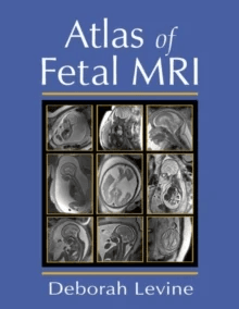 Atlas of Fetal MRI av Deborah (Beth Israel Deaconess Medical Center Boston MA USA) Levine