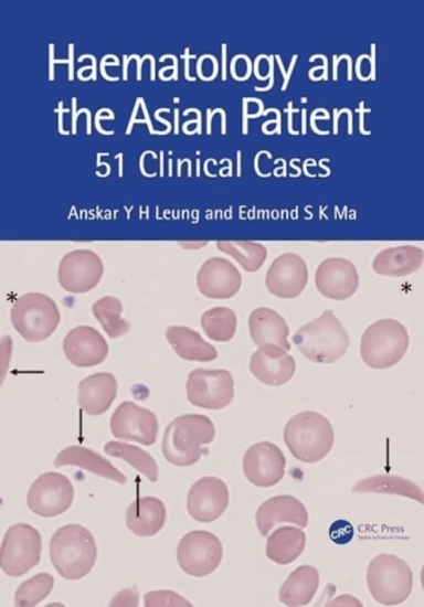 Haematology and the Asian Patient av Anskar Y.H. (University of Hong Kong) Leung, Edmond S K Ma