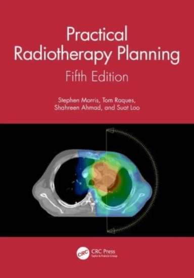 Practical Radiotherapy Planning av Stephen (Guy's and St Thomas' NHS Foundation Trust London) Morris, Tom (Norfolk and Nowrich University Ho
