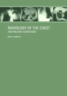 Radiology of the Chest and Related Conditions av F W Wright