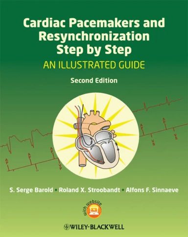 Cardiac Pacemakers and Resynchronization Step by Step av S. Serge (University of South Florida and Florida Heart Rhythm Institute) Barold, Roland X. S