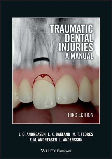 Traumatic Dental Injuries av Jens O. (University Hospital (Rigshospitalet) Copenhagen Denmark) Andreasen, Leif K. (Loma Linda University California US