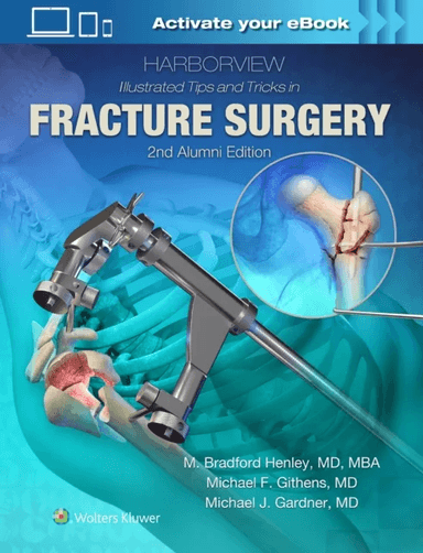 Harborview Illustrated Tips and Tricks in Fracture Surgery av M. Henley