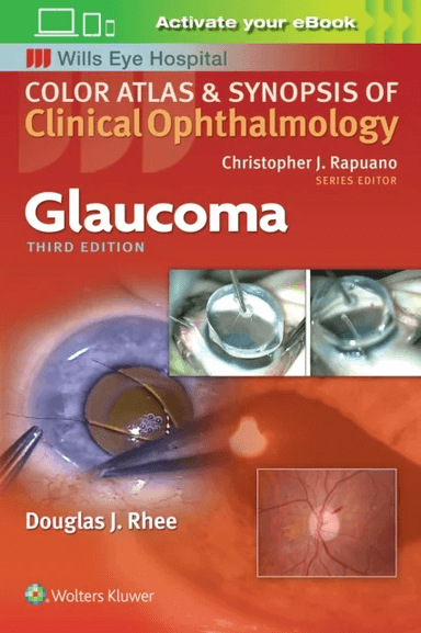 Glaucoma av Douglas Rhee