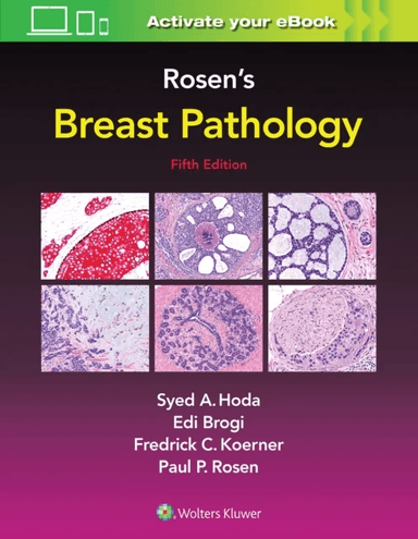 Rosen's Breast Pathology av Syed A. Hoda, Paul Peter MD Rosen, Edi Brogi, Frederick C. Koerner