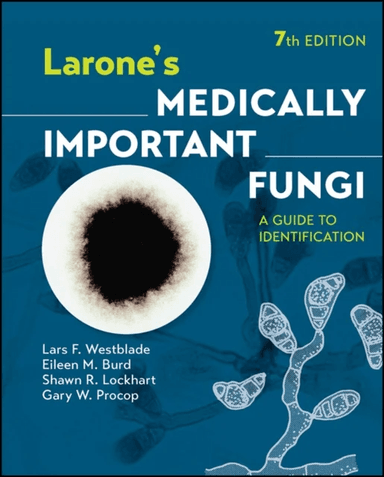 Larone's Medically Important Fungi av Lars F. (Weill Medical College of Cornell University Westblade, Washington University School of Medicine in