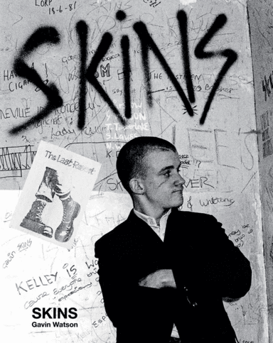Skins av Gavin Watson