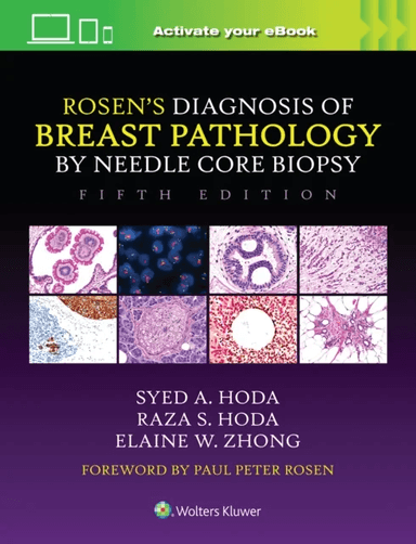 Rosen's Diagnosis of Breast Pathology by Needle Core Biopsy av Syed A. Hoda, Raza S. Hoda, Elaine Zhong