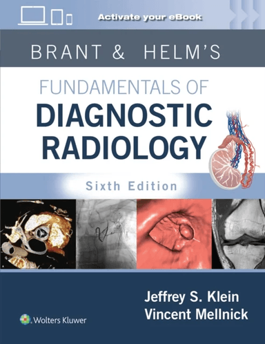 Brant &amp; Helm's Fundamentals of Diagnostic Radiology: Print + eBook with Multimedia av Jeffrey MD FACR Klein, Vincent Mellnick
