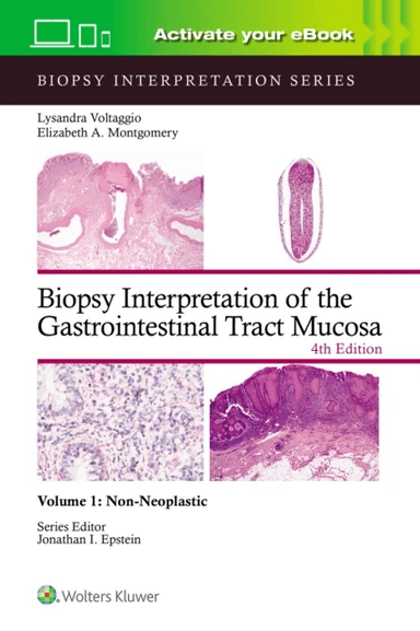 Biopsy Interpretation of the Gastrointestinal Tract Mucosa Volume 1 av LYSANDRA VOLTAGGIO, ELIZABETH ANNE MONTGOMERY