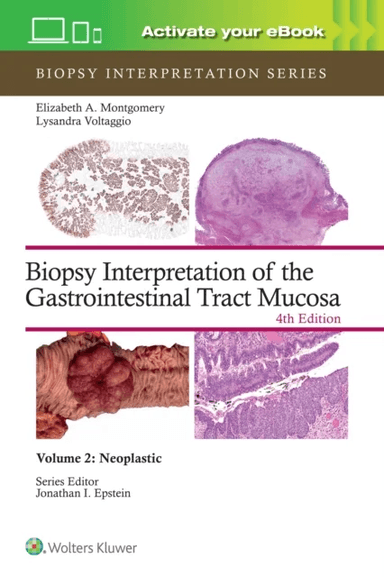 Biopsy Interpretation of the Gastrointestinal Tract Mucosa Volume 2 av ELIZABETH ANNE MONTGOMERY, LYSANDRA VOLTAGGIO
