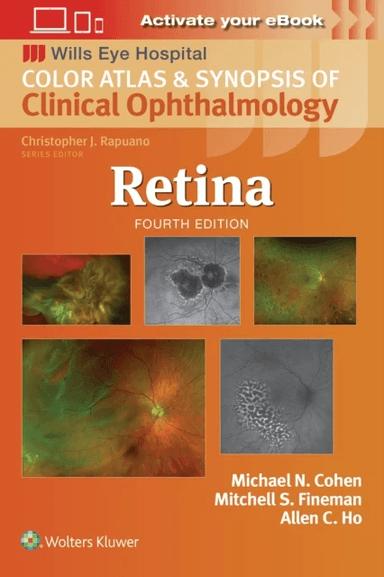 Retina av Mitchell S. Fineman