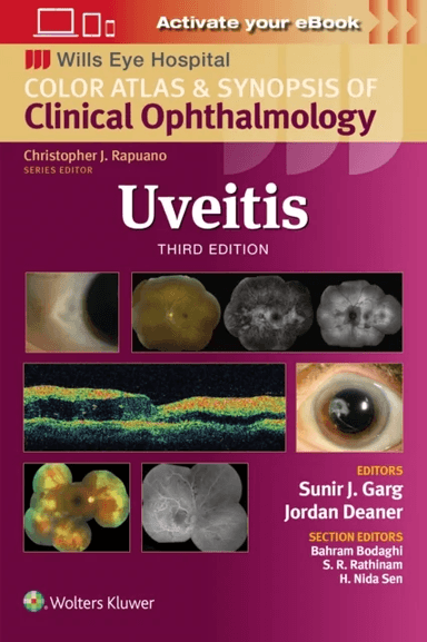 Uveitis av Sunir J. Garg