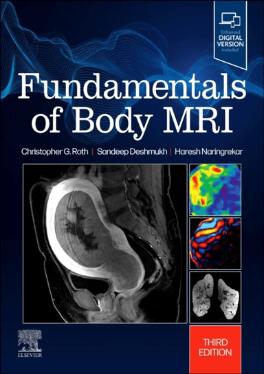 Fundamentals of Body MRI av Christopher G. (Professor Interim Chair Department of Radiology Thomas Jefferson University Philadelphia Pennsylvania) Rot