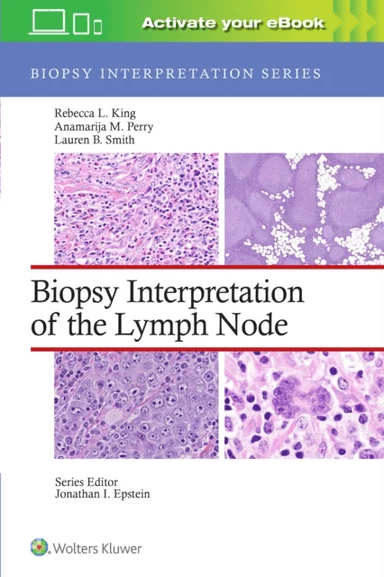 Biopsy Interpretation of the Lymph Node av Rebecca Leigh MD King, Anamarija M. MD Perry, Lauren B. Smith